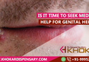Is It Time To Seek Medical Help for Genital Herpes