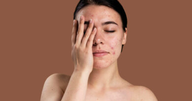 Effective Traditional  Ayurvedic Treatment of Syphilis
